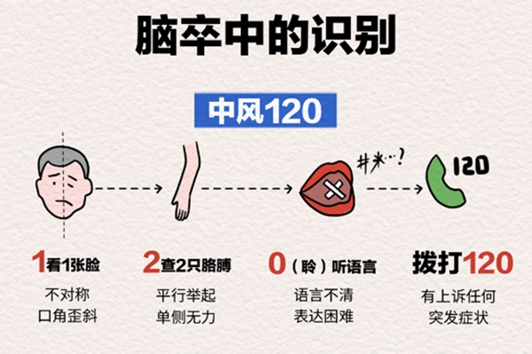 “中風120”口訣。重慶松山醫(yī)院供圖